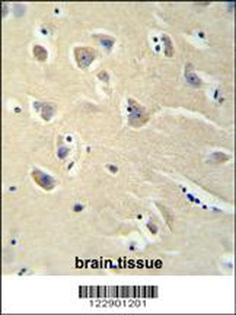 PENK Antibody (Center)