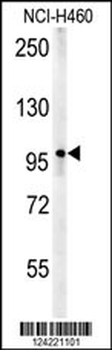ZC3HAV1 Antibody (C-term)