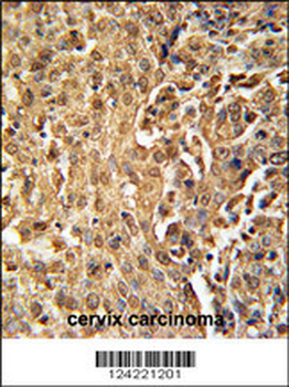 ZC3HAV1 Antibody (C-term)