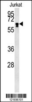 BTBD9 Antibody (Center)