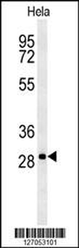 TM165 Antibody (N-term)