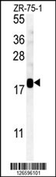 SDHAF1 Antibody (Center)