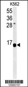 HIST1H2AK Antibody (N-term)