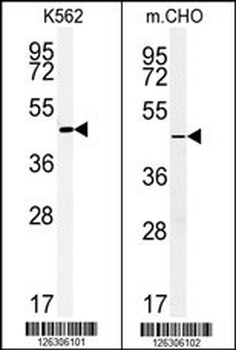 ENTPD8 Antibody (C-term)