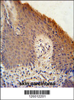 KRTAP1-1 Antibody (Center)