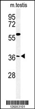 CCD92 Antibody (Center)