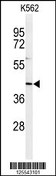IN80B Antibody (Center)