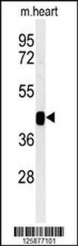 B3GNT7 Antibody (Center)