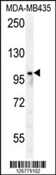 PARP8 Antibody (Center)