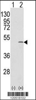CAPZB Antibody (C-term)