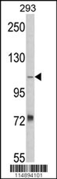 AASS Antibody (Center)