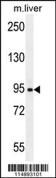 AASS Antibody (Center)