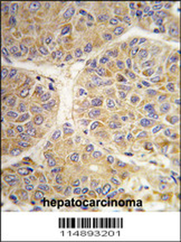 AASS Antibody (Center)