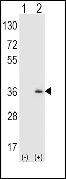 SULT1A1 Antibody (Center)
