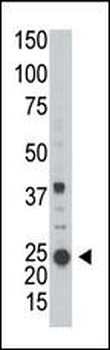 ARL3 Antibody (C-term)