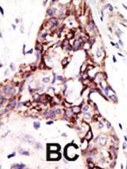 ARL3 Antibody (C-term)