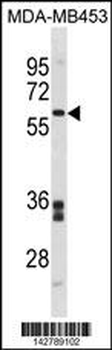 FMO5 Antibody (C-term)