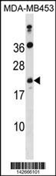 ATP5S Antibody (N-term)