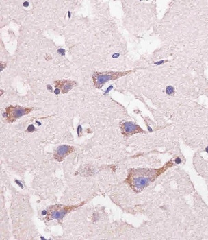 Nestin (S1409) antibody