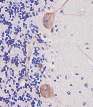 Nestin (S1409) antibody