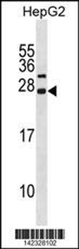 CDKN3 Antibody (N-term)