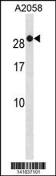 RAB7B Antibody (C-term)