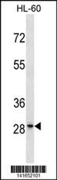 GRRP1 Antibody(C-term)