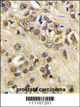 MYC Antibody (T58)