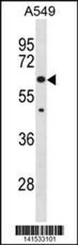 KLHL30 Antibody(C-term)