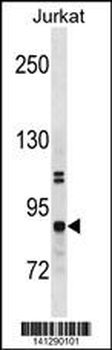 CHUK Antibody(N-term)