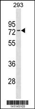 ESR1 isoform1 Antibody(N-term)