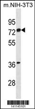 ESR1 isoform1 Antibody(N-term)