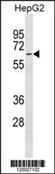 MFSD4 Antibody(Center)
