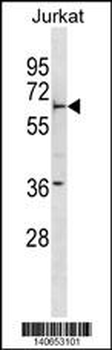 FBXW5 Antibody(Center)