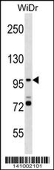 SMG5 Antibody (C-term)
