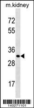 Mouse Ctsl1 Antibody (C-term)