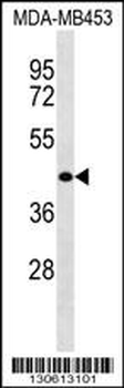 WASH2P Antibody (N-term)