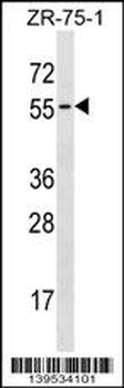 TCN1 Antibody (C-term)