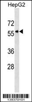 KPNA5 Antibody (N-term)