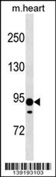 XYLT2 Antibody (N-term)