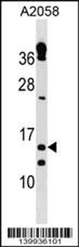 TXNRD3IT1 Antibody (C-term)