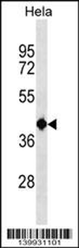 TSEN2 Antibody (N-term)