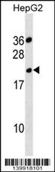 TMPRSS11BNL Antibody (Center)