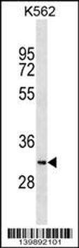 SYCE1L Antibody (C-term)