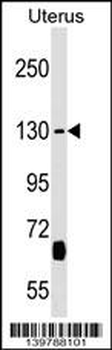 KIF27 Antibody (C-term)