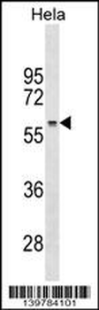 RRP1 Antibody (Center)