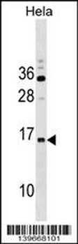 RPP14 Antibody (C-term)