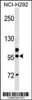 GOLGA6B Antibody (Center)