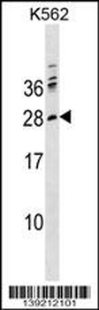 PTCRA Antibody (C-term)