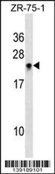 RHOH Antibody (C-term)